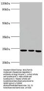 BAG2 Antibody