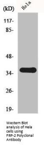 SFRP2 Antibody