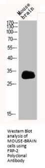 SFRP2 Antibody