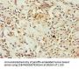 BCKDK Antibody