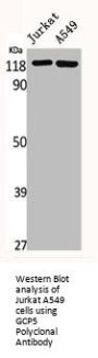 TUBGCP5 Antibody