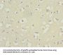 BFAR Antibody