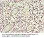 BFAR Antibody