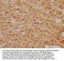 BLVRB Antibody
