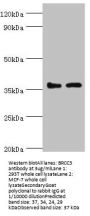 Rabbit anti-human Lys-63-specific deubiquitinase BRCC36 polyclonal Antibody(BRCC3)