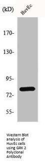 ADRBK1 Antibody