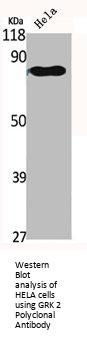ADRBK1 Antibody