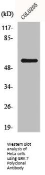 GRK 7 Polyclonal Antibody