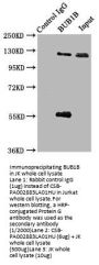 BUB1B Antibody