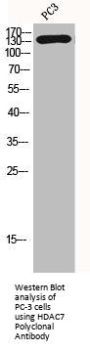 HDAC7 Antibody