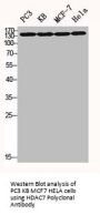 HDAC7 Antibody