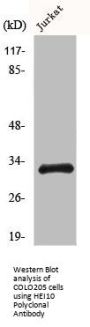 CCNB1IP1 Antibody