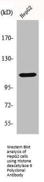HDAC9 Antibody