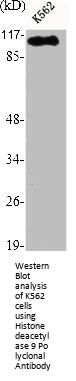 HDAC9 Antibody