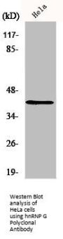 RBMX Antibody