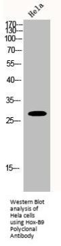 HOXB9 Antibody
