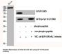IGF1R/INSR Antibody
