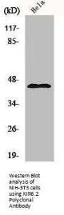 KCNJ11 Antibody