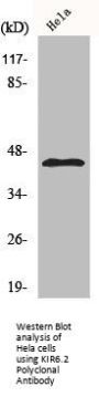 KCNJ11 Antibody