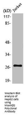 KCNMB2 Antibody