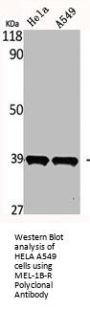 MEL-1B-R Polyclonal Antibody