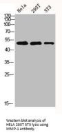 MMP1 Antibody