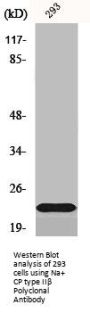 SCN2B Antibody