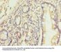 HEATR9 Antibody