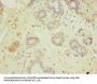 HEATR9 Antibody