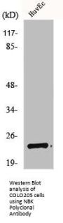 BIK Antibody