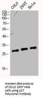 CDKN1B Antibody