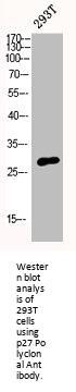 CDKN1B Antibody