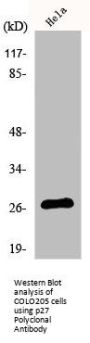 CDKN1B Antibody