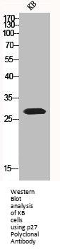 CDKN1B Antibody