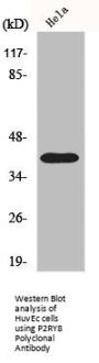 P2RY8 Antibody