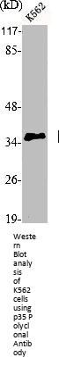 CDK5R1 Antibody