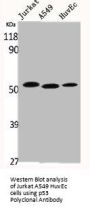 TP53 Antibody
