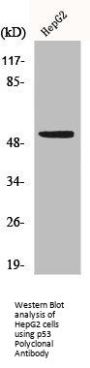 p53 Polyclonal Antibody