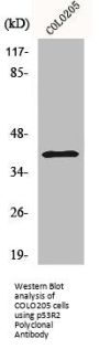 RRM2B Antibody