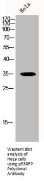 RNF144B Antibody
