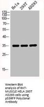 RNF144B Antibody