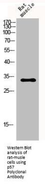 CDKN1C Antibody