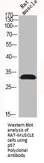 CDKN1C Antibody