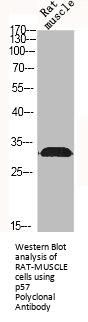 CDKN1C Antibody