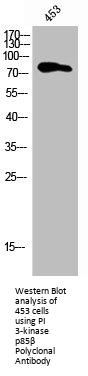 PIK3R2 Antibody