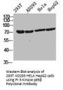 PIK3R2 Antibody