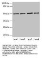 EVA1C Antibody