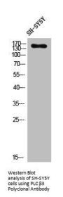 PLCB3 Antibody