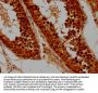 SYCE3 Antibody