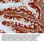 SYCE3 Antibody